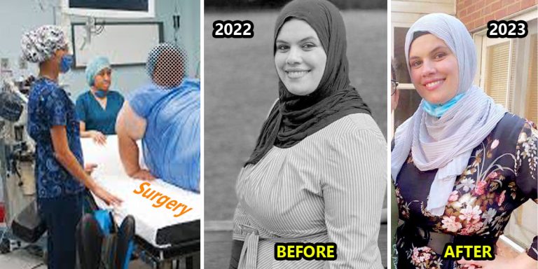 Weight Loss Surgery in Mexico & Cost 2023
