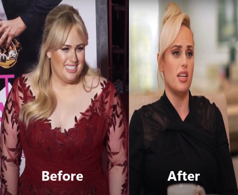 Weight Loss Before and after