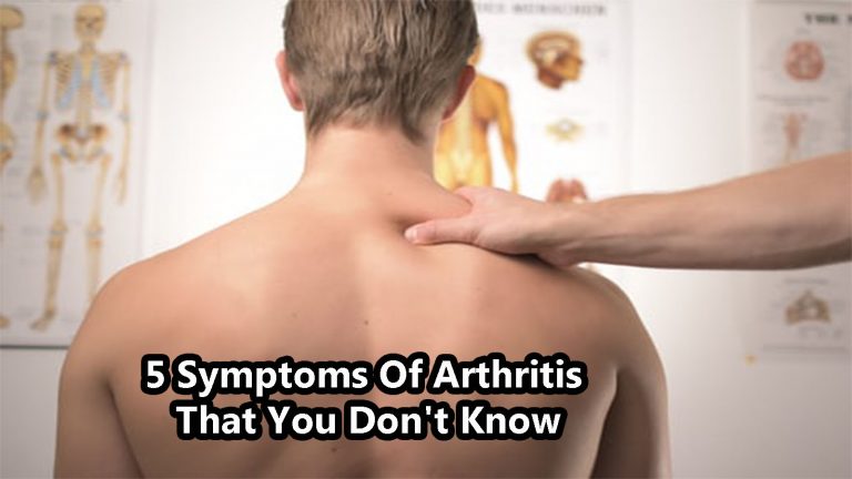 5 Symptoms Of Arthritis That You Don't Know