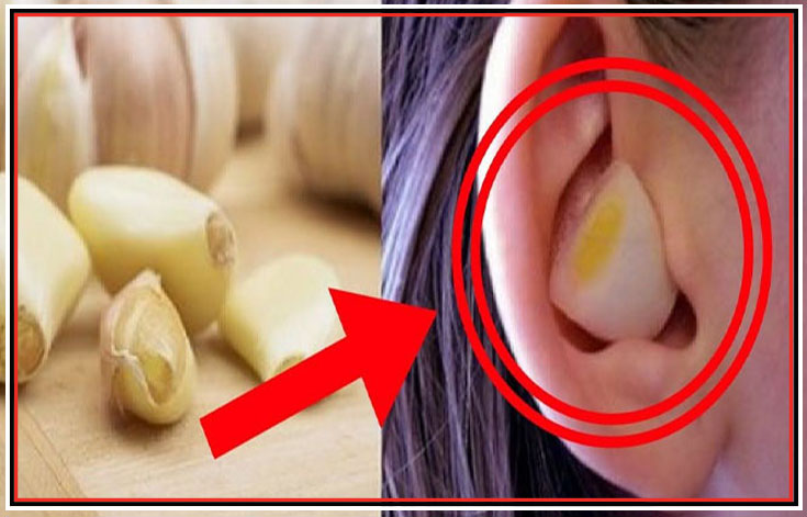 Put A Slice of Garlic In Your Ear And Then Look Amazing